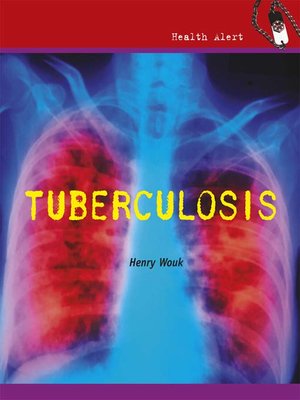 cover image of Tuberculosis